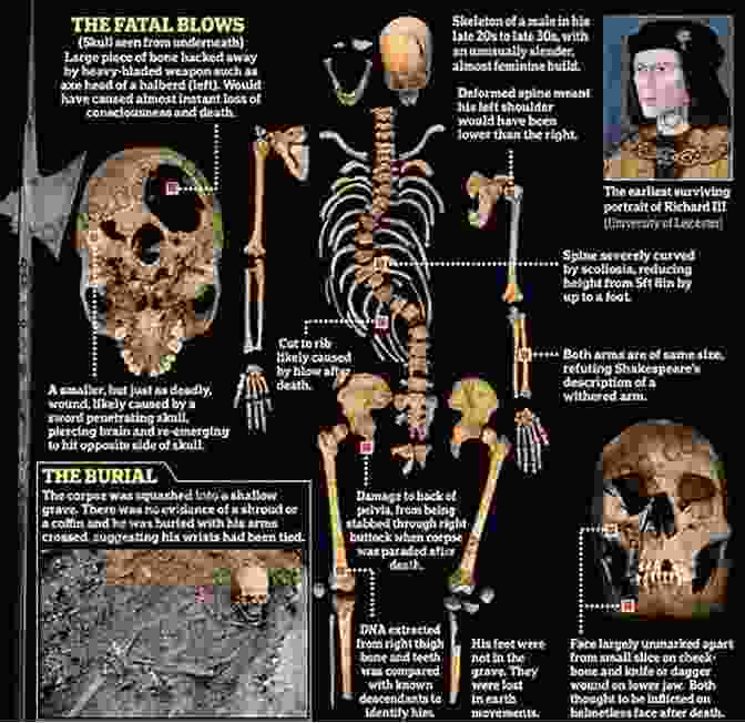 A Photograph Of The Skeletons Of King Richard III, Which Were Discovered In A Car Park In Leicester In 2012 Richard III Makers Of History