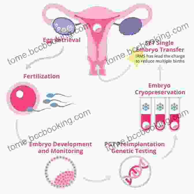 In Vitro Fertilization (IVF) Procedure Infertility: Cure And Assisted Reproduction